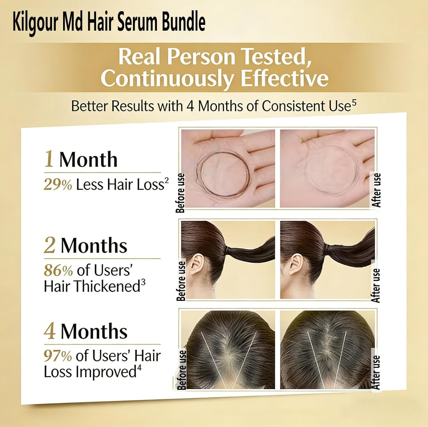 Kilgour Md Hair Serum Bundle | Plant-Based Hair Care Essence for Women 2FL OZ