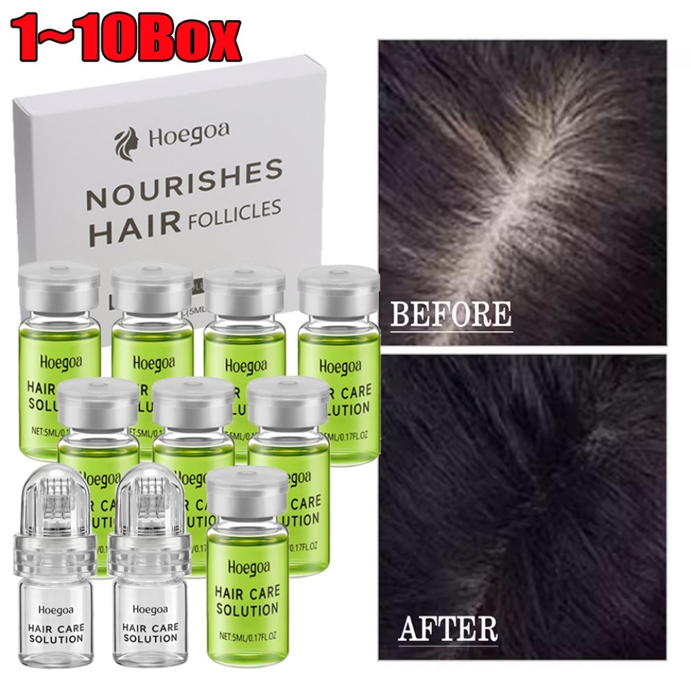 8-80Pcs MICRONEEDLE Hair Regrowth System, Advanced Hair Treatment Ginseng Serum