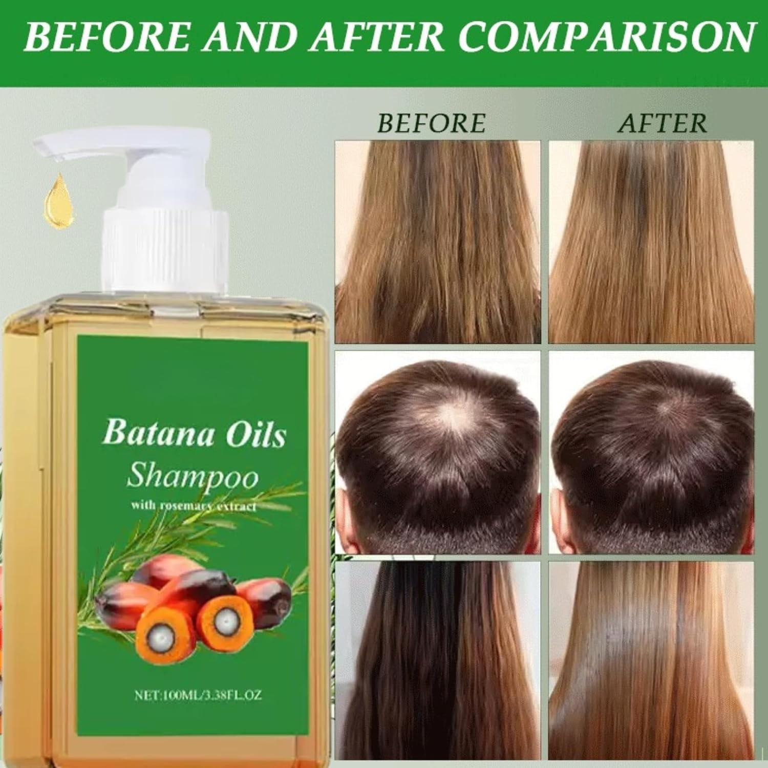 2Pcs Batana Oil Shampoo, Rosemary Oil Shampoo, 100% Batana Oil with Rosemary …