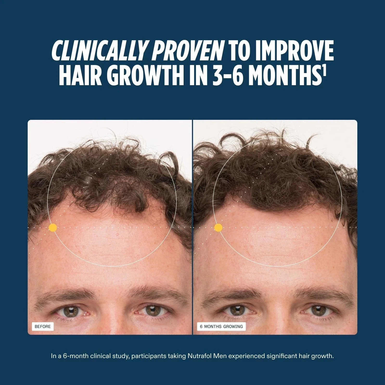 NUTRAFOL Men’s AUTHENTIC Hair Growth 1 Bottle 120 Pills 1 month supply