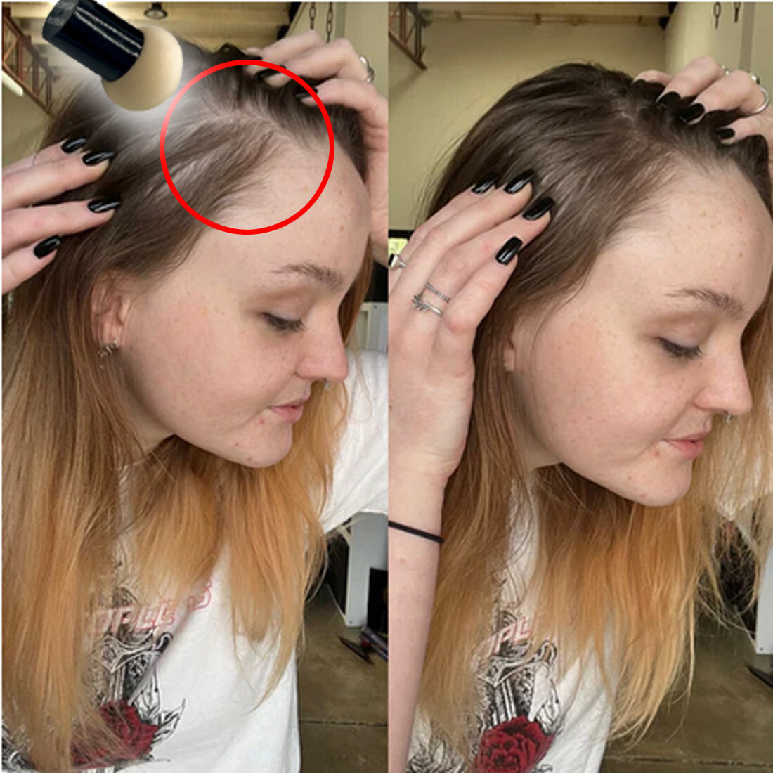 Extra Large Hairline Filler Root Touch-Up Hair loss Concealer Bald Spot Coverage