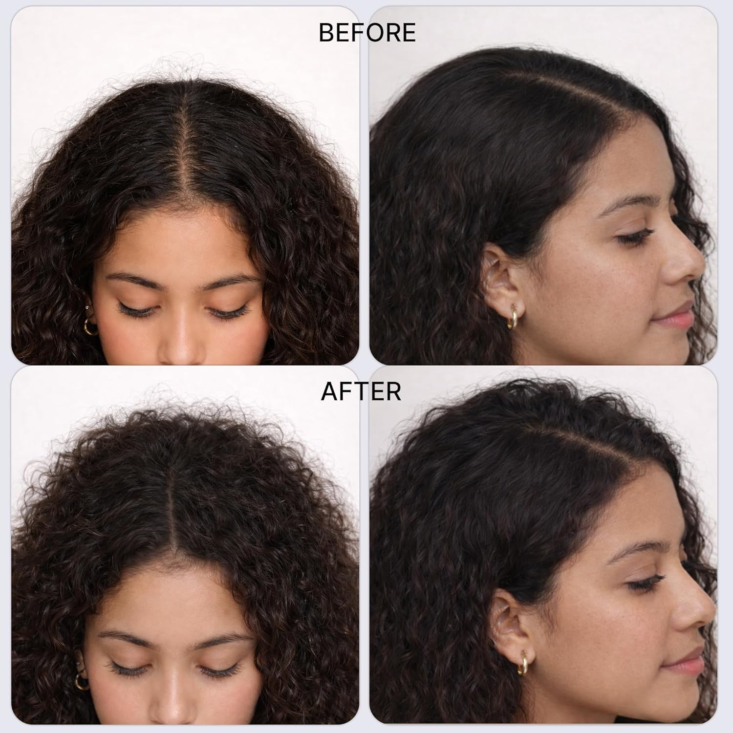 Hair Thickening Serum Helps Reduce Hair Loss Hair Growth Serum Roll On