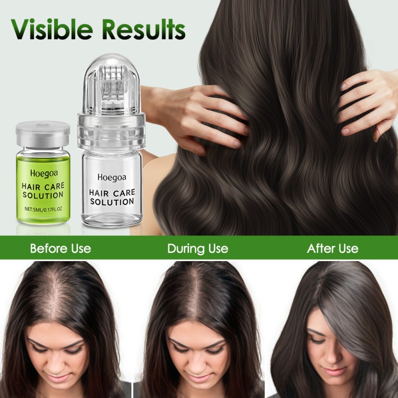 8PCS/SET MICRONEEDLE Hair Regrowth System, Advanced Hair Treatment Ginseng Serum