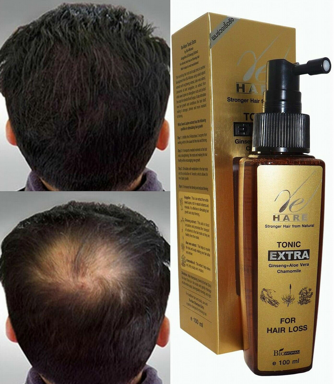 HAIR LOSS TONIC Fast Grow Regrowth Treatment in 60 DAYS