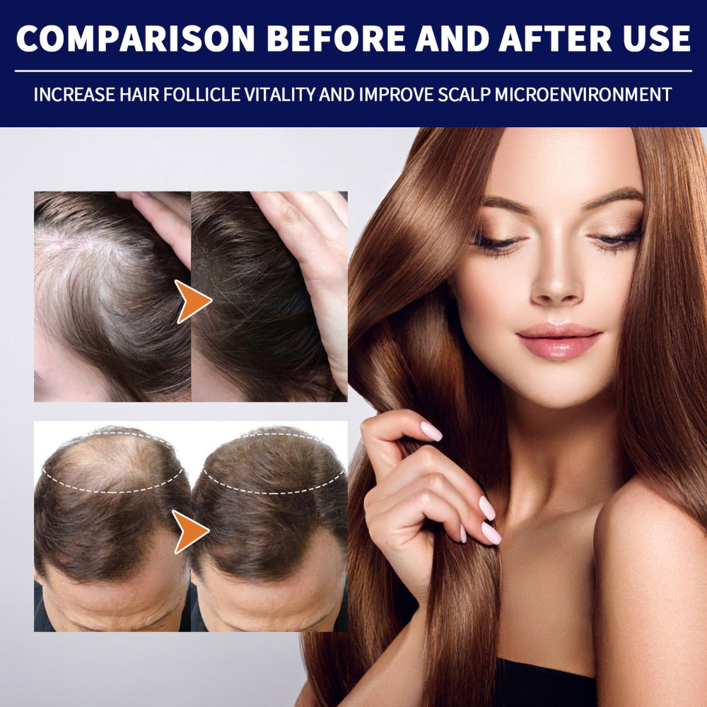 Hair Repair Liquid Moisturizing and Nutritious Hair Scalp Deep