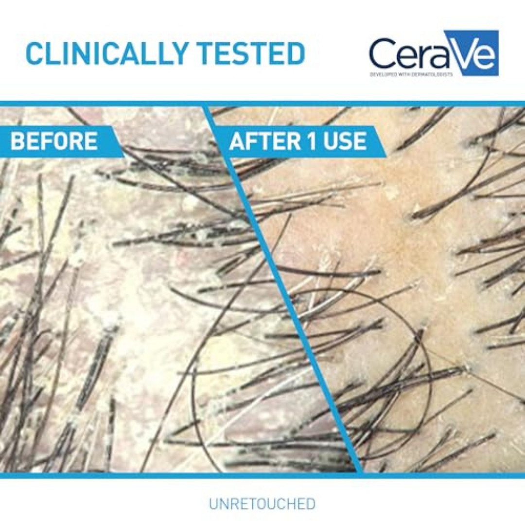 Cerave Hydrating anti Dandruff Shampoo, 1% Pyrithione Zinc Dandruff Treatment