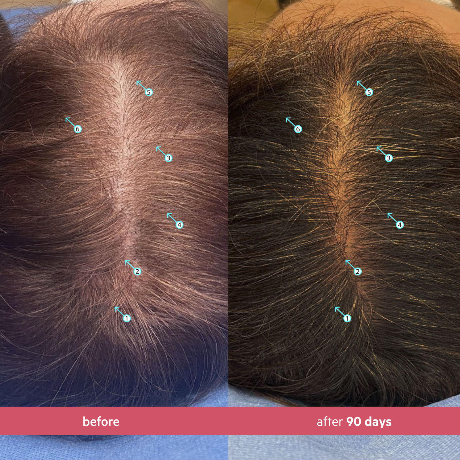 Spectral CSF® Hair Revitalizing System for Women by DS Laboratories