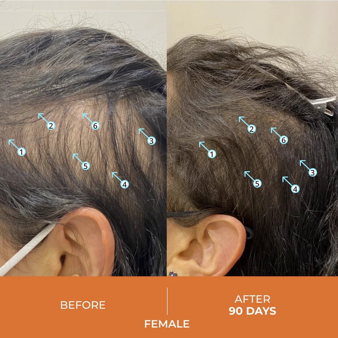 REVITA Hair Growth Shampoo (205ml) – For Hair Loss for Men & Women