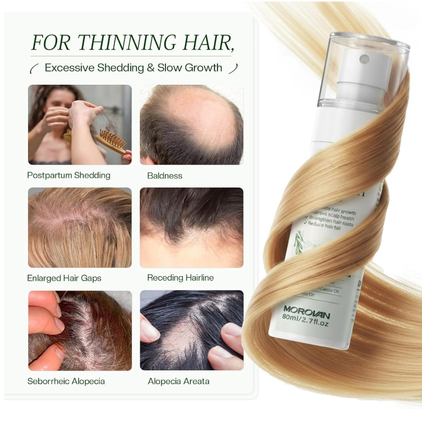 Hair Growth Spray Rosemary Oil Biotin Caffeine Castor Oil Anti Hair