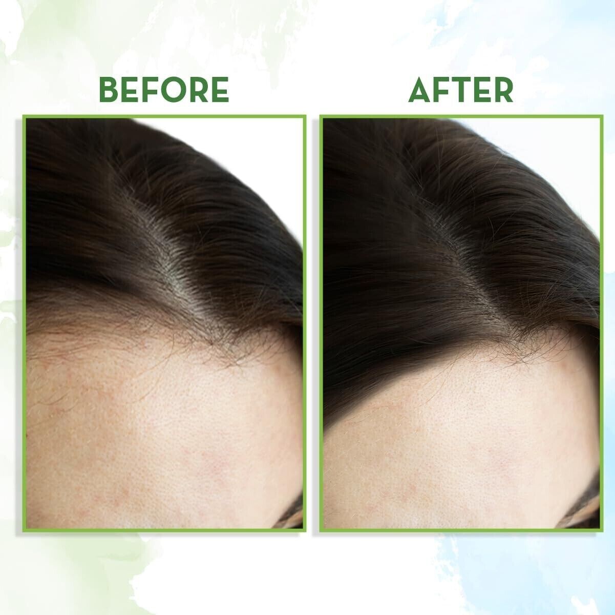 Mamaearth Rosemary Hair Growth Oil with Rosemary & Methi Dana | 150 ML