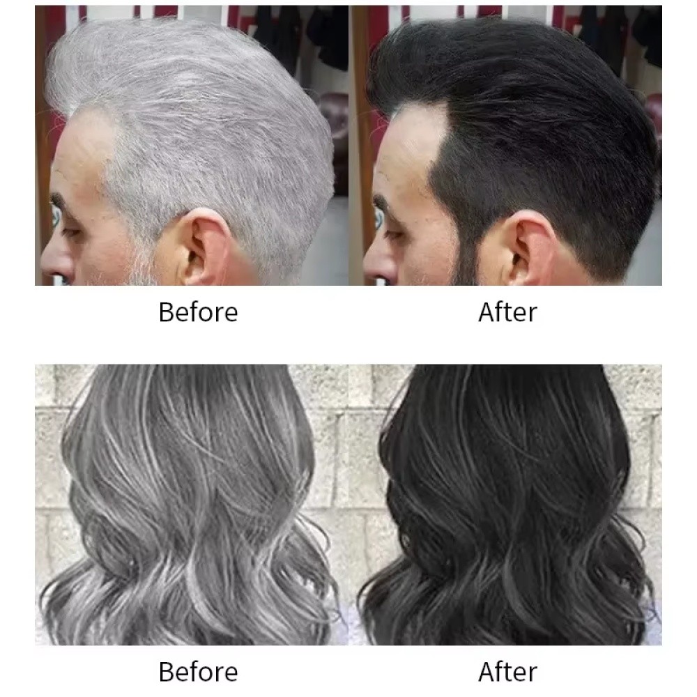 10-100X DEXE Black Hair Shampoo Natural Instant 5-Min Hair Color Dye for Unisex