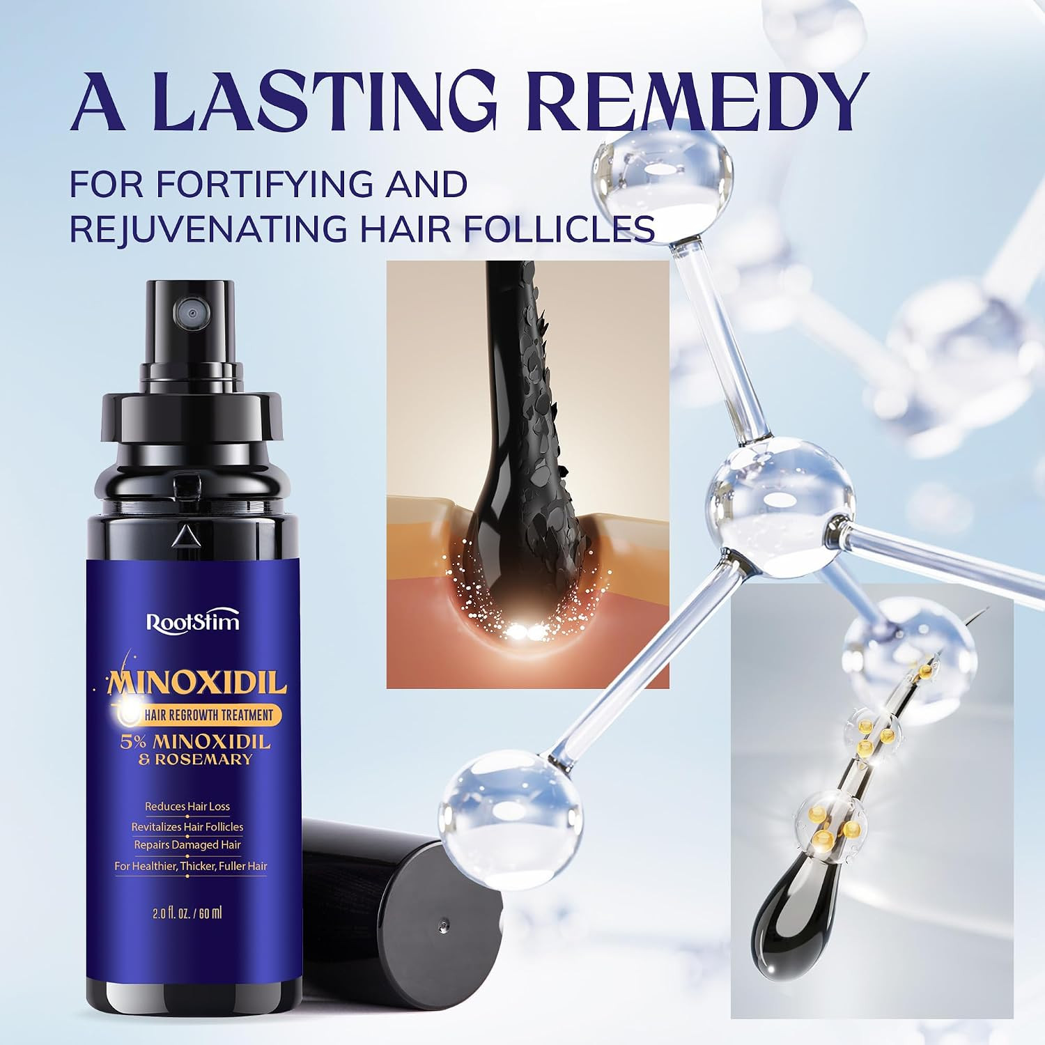 5% Minoxidil Hair Growth Spray for men and women