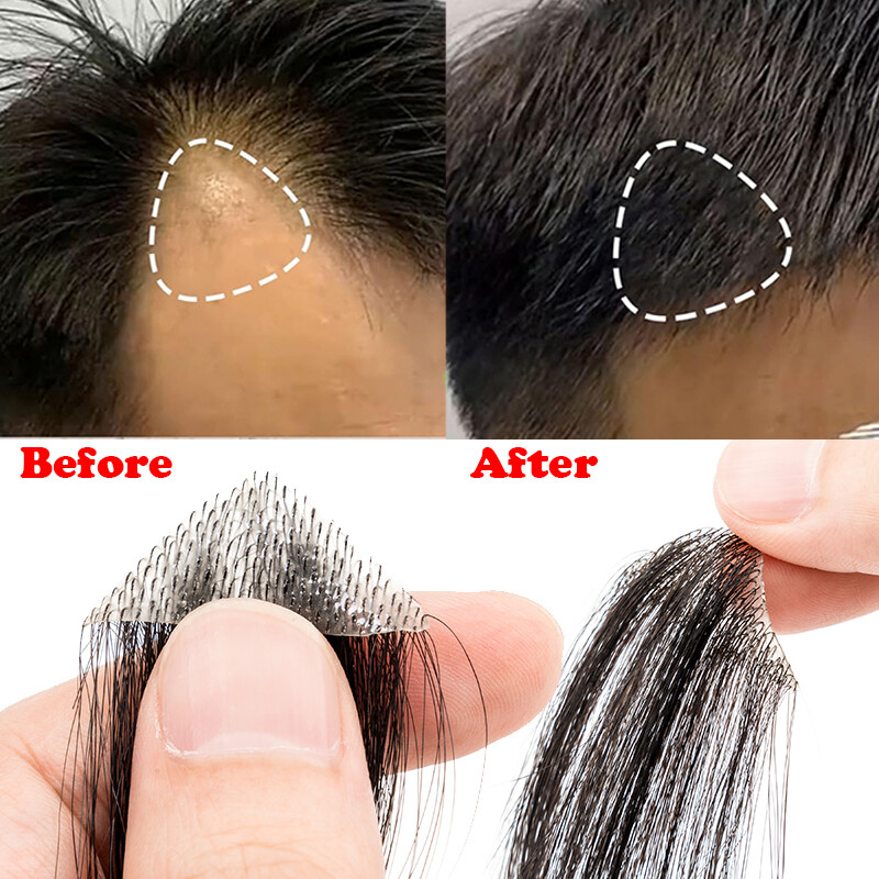 Bald Spot Human Hair Patch Toupee For Men Replacement Unit PU Ultra Thin Skin UK