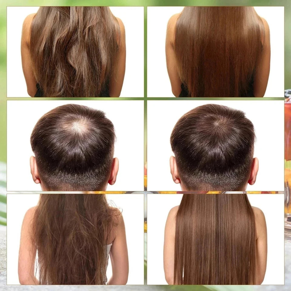 Azure Batana Oil for Hair Growth, Azure Batana Oil, Batana Oil,100% Honduran Oil