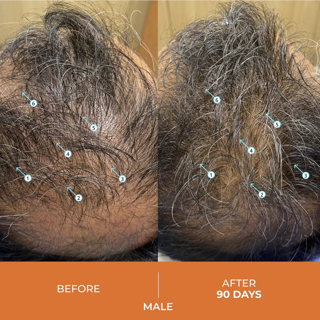 REVITA Hair Growth Shampoo (205ml) – For Hair Loss for Men & Women