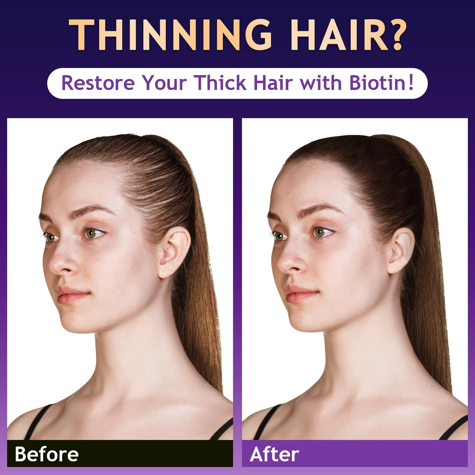 Hair Growth Biotin Shampoo for Thinning Hair – Sulfate-Free, 10.1 Fl Oz