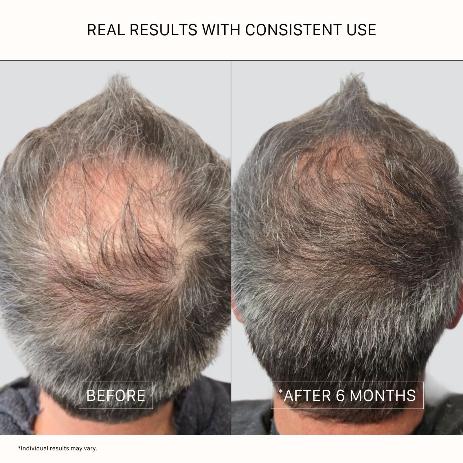 Thickening Conditioner for Unisex | Strengthens & Adds Volume for Fuller Hair