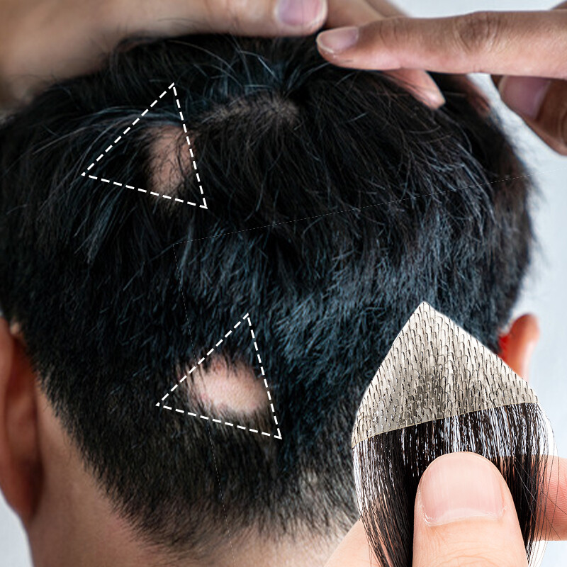 Bald Spot Human Hair Patch Toupee For Men Replacement Unit PU Ultra Thin Skin UK