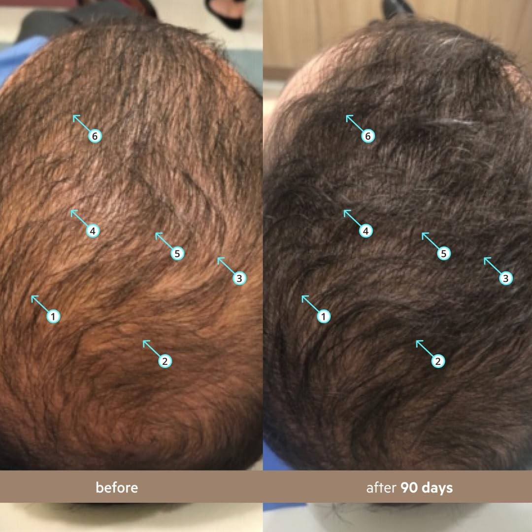 Men’s Hair Density Serum 60mL – Fast Absorbing, Non-Greasy, Thicker Hair