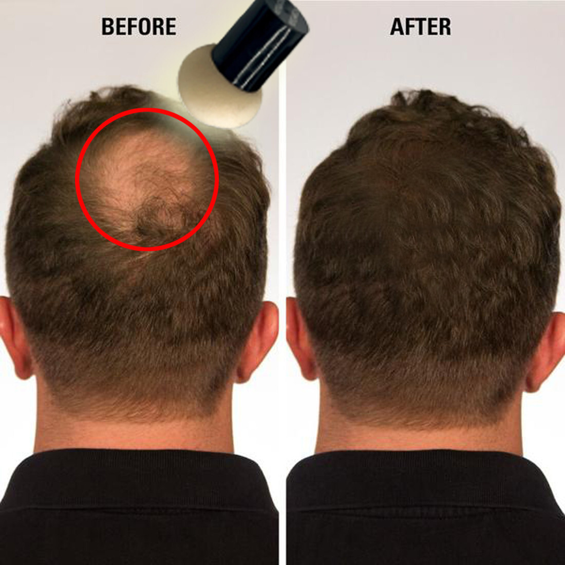 Extra Large Hairline Filler Root Touch-Up Hair loss Concealer Bald Spot Coverage