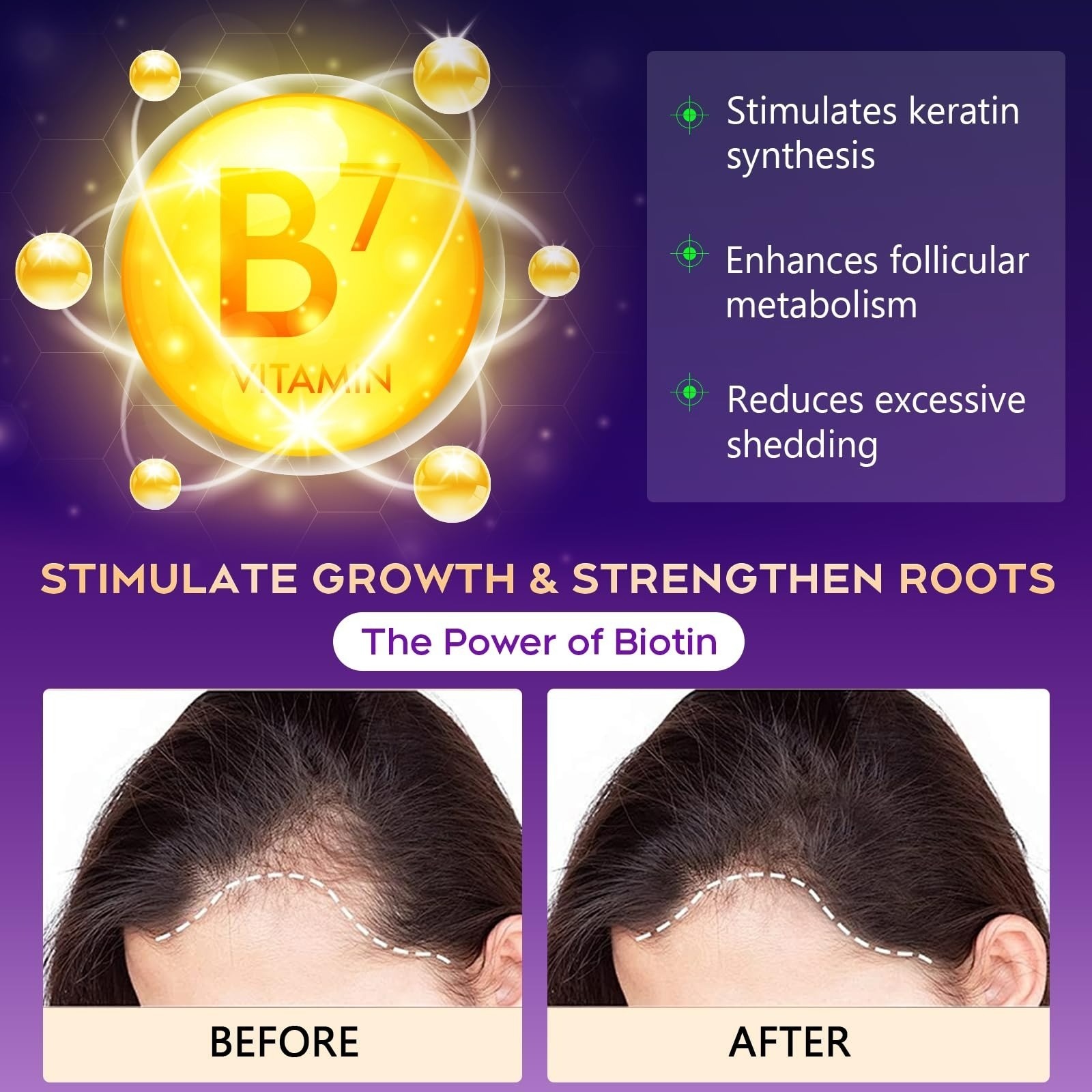 Hair Growth Biotin Shampoo for Thinning Hair – Sulfate-Free, 10.1 Fl Oz