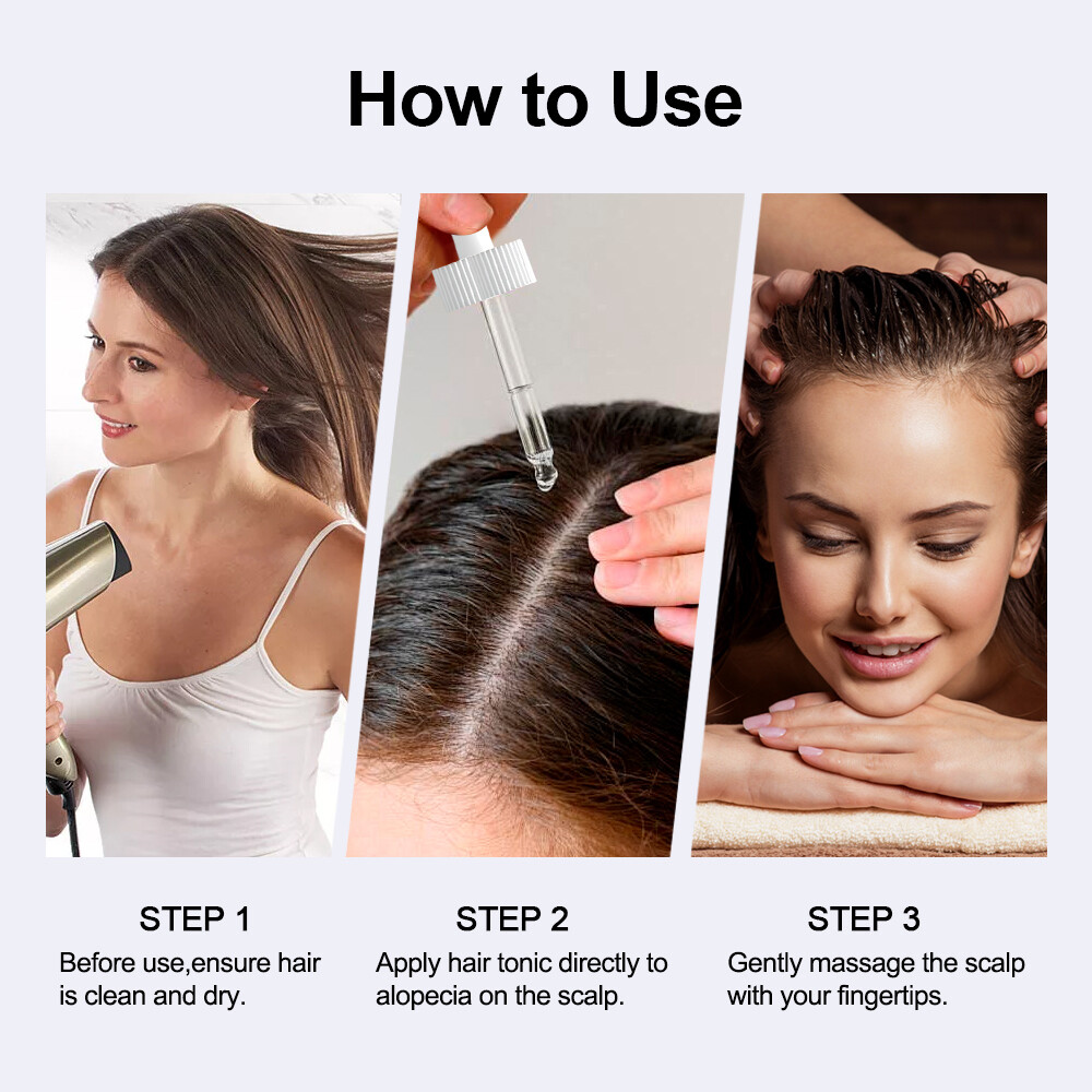 Minoxidil 5% Extra Strength for Men&Women Hair Regrowth Solution 6 Month Supply