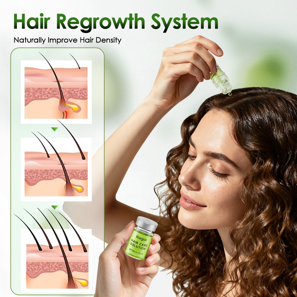 Hair Regrowth System,Advanced Alpha Infuse Microneedle Hair Regrowth Treatment
