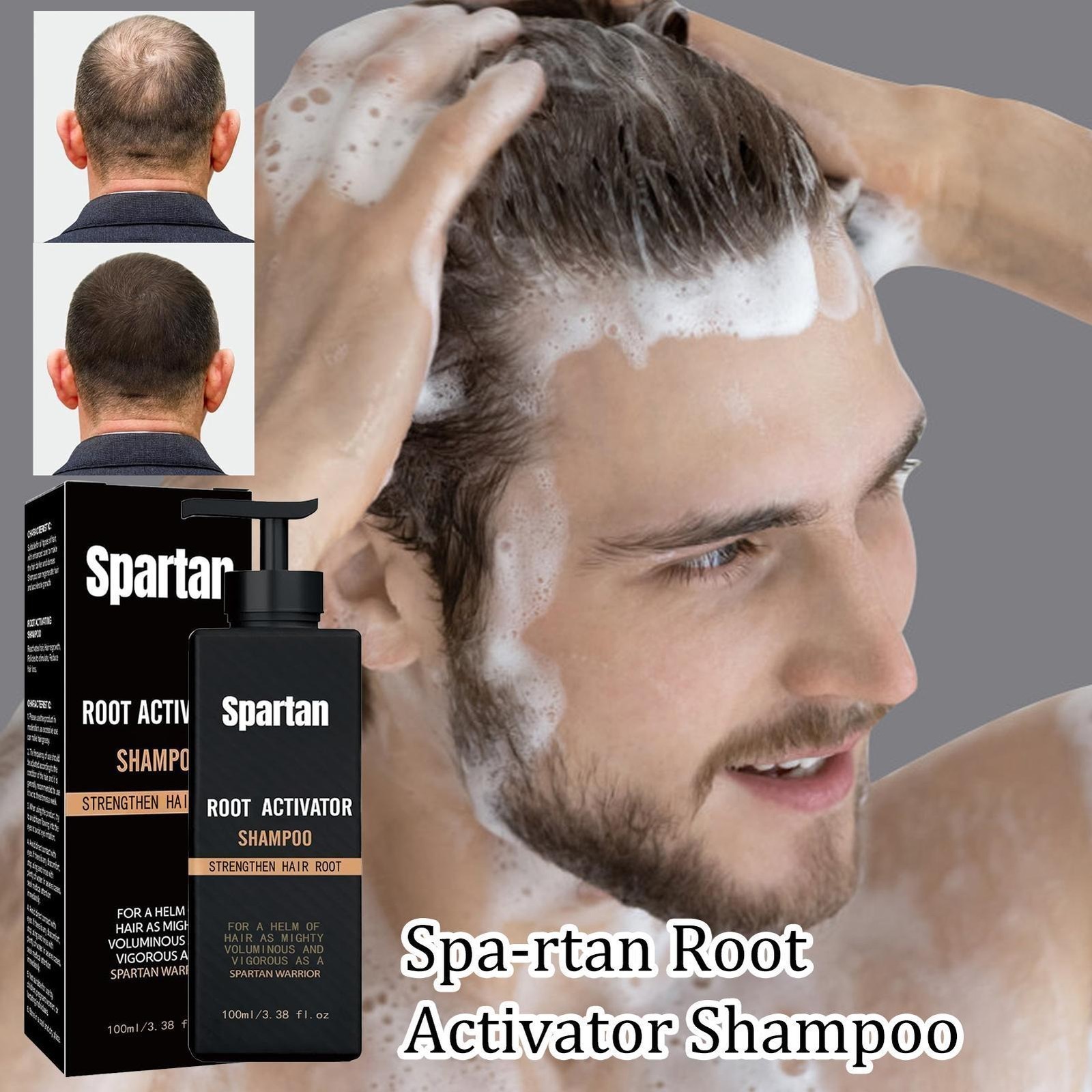 1-5x Root Activator Shampoo, SPARTAN Hair Loss Shampoo,Shampoo Root Activator US