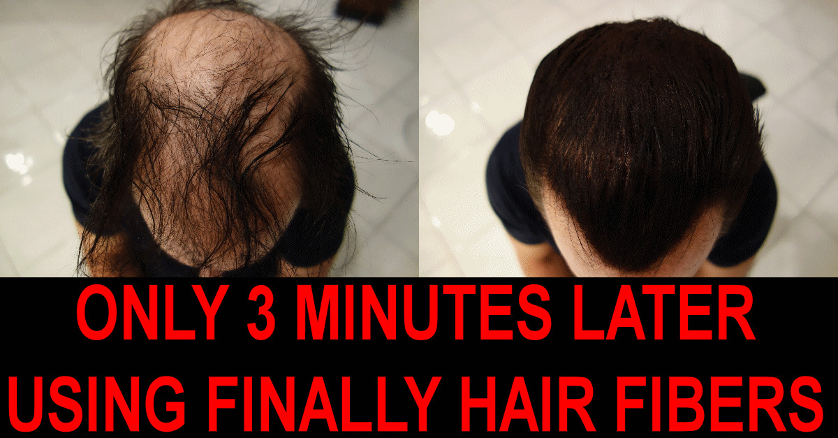 Keratin Hair Building Fibers Bottle 28g FINALLY HAIR Loss Concealer Filler Fiber