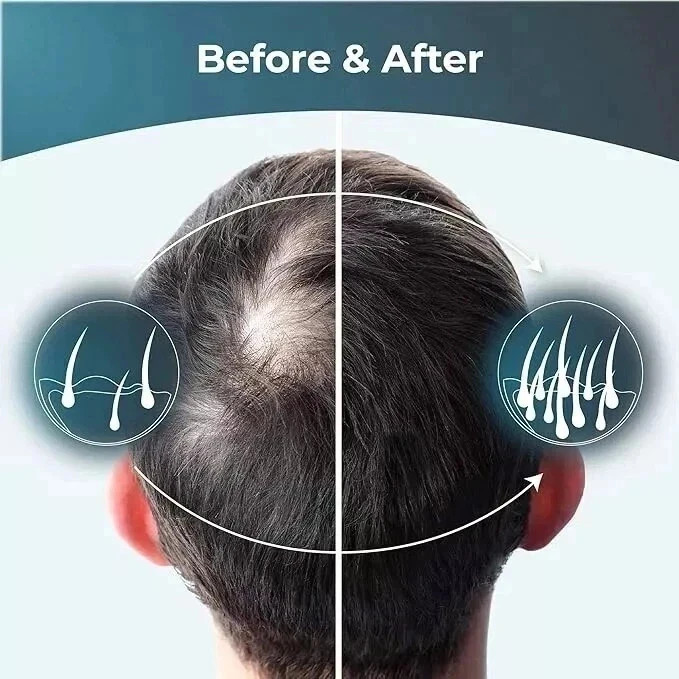 ReGrow Hair Growth Vitamins with Biotin, Hair Supplement by PureHealth 60 Capsul