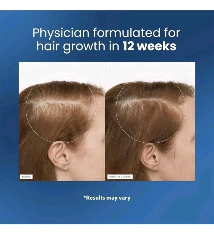*3-Pack* Hair Growth Serum – Be Bodywise 3% Rosemary 3% Redensyl 25ml 9/4/2027