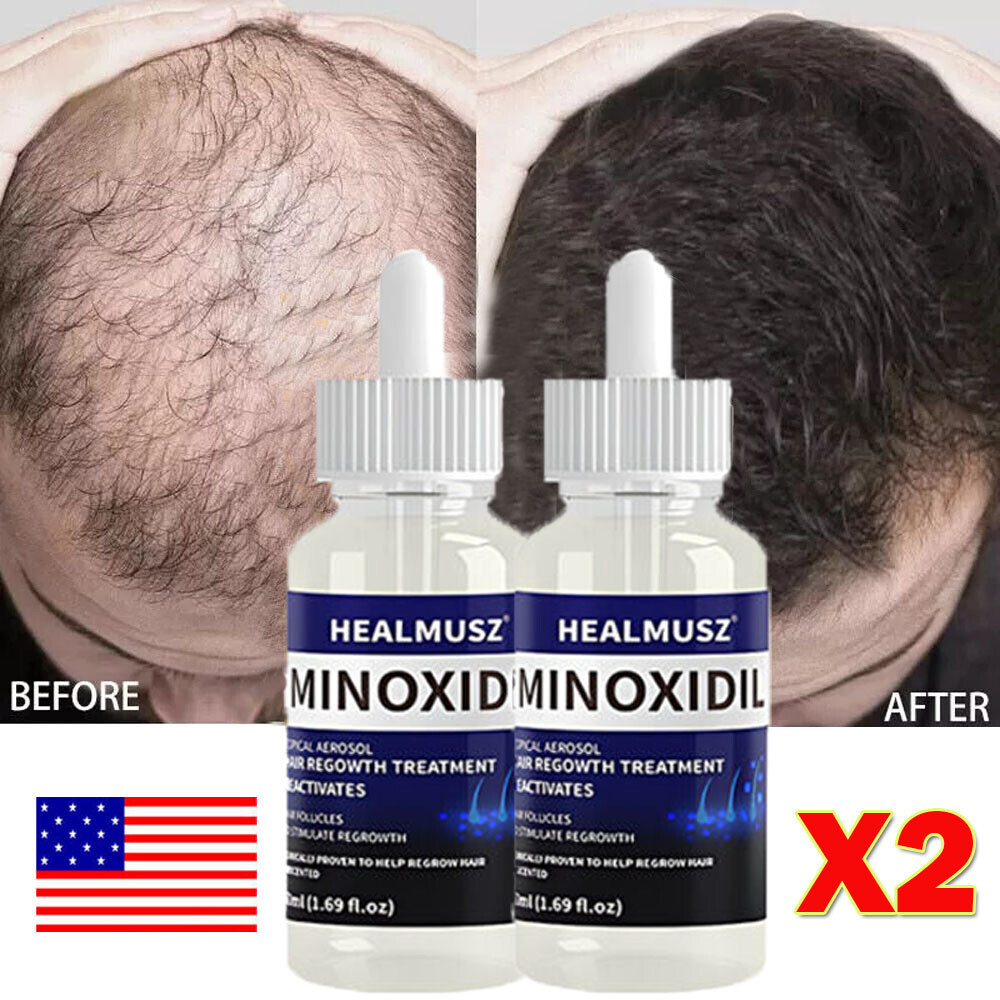 Hair Regrowth Liquid- 5% Minoxidil Topical Solution for Thicker Hair Grow 50ml*2